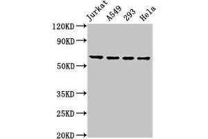 Western Blot Positive WB detected in: Jurkat whole cell lysate, A549 whole cell lysate, 293 whole cell lysate, Hela whole cell lysate All lanes: TAF15 antibody at 8.