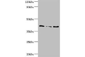 Western blot All lanes: Serpin B5 antibody at 10 μg/mL Lane 1: HepG2 whole cell lysate Lane 2: Hela whole cell lysate Lane 3: A431 whole cell lysate Secondary Goat polyclonal to rabbit IgG at 1/10000 dilution Predicted band size: 43, 26 kDa Observed band size: 43 kDa (SERPINB5 anticorps  (AA 21-189))