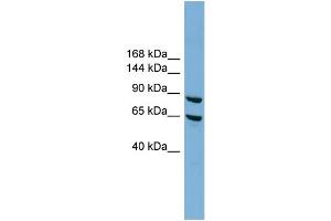 WB Suggested Anti-EXOC6 Antibody Titration: 0.