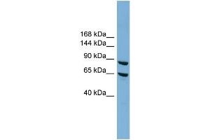 WB Suggested Anti-EXOC6 Antibody Titration: 0. (EXOC6 anticorps  (N-Term))