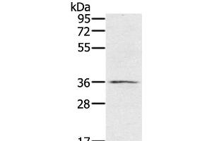 Western Blot analysis of TM4 cell using p53RFP Polyclonal Antibody at dilution of 1:400 (RNF144B anticorps)