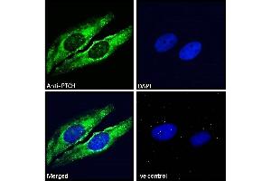 ABIN185521 Immunofluorescence analysis of paraformaldehyde fixed HeLa cells, permeabilized with 0.