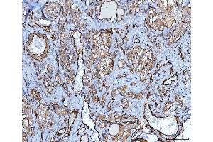 IHC analysis of PTRF/CAVIN1 using anti-PTRF/CAVIN1 antibody (ABIN7601817). (PTRF anticorps  (AA 47-390))