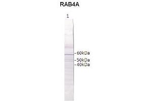 Western Blotting (WB) image for anti-RAB4B, Member RAS Oncogene Family (RAB4B) (Middle Region) antibody (ABIN2788152) (RAB4B anticorps  (Middle Region))