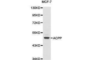 Western Blotting (WB) image for anti-Acid Phosphatase, Prostate (ACPP) antibody (ABIN1870774) (ACPP anticorps)