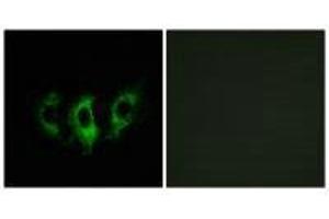 Immunofluorescence analysis of A549 cells, using GFM2 antibody. (GFM2 anticorps)