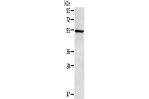 Gel: 8 % SDS-PAGE, Lysate: 40 μg, Lane: A172 cells, Primary antibody: ABIN7192889(TRIM22 Antibody) at dilution 1/250, Secondary antibody: Goat anti rabbit IgG at 1/8000 dilution, Exposure time: 3 minutes (TRIM22 anticorps)
