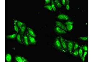 Immunofluorescent analysis of Hela cells using ABIN7155356 at dilution of 1:100 and Alexa Fluor 488-congugated AffiniPure Goat Anti-Rabbit IgG(H+L)