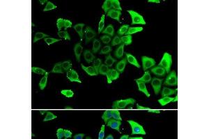 Immunofluorescence analysis of U2OS cells using SGCD Polyclonal Antibody (SGCD anticorps)