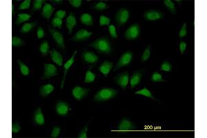 Immunofluorescence of monoclonal antibody to ZHX2 on HeLa cell. (ZHX2 anticorps  (AA 691-788))