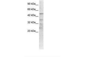Image no. 1 for anti-Acetylcholine Receptor Subunit alpha (CHRNA1) (AA 25-74) antibody (ABIN6735455) (CHRNA1 anticorps  (AA 25-74))