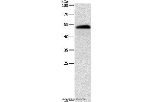 Western blot analysis of Human liver cancer tissue, using ALDH1B1 Polyclonal Antibody at dilution of 1:900 (ALDH1B1 anticorps)