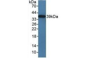Detection of Recombinant TICAM1, Mouse using Polyclonal Antibody to Toll Like Receptor Adaptor Molecule 1 (TICAM1) (TICAM1 anticorps  (AA 263-526))
