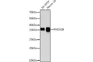 Western blot analysis of extracts of various cell lines, using PHOX2B Rabbit mAb (ABIN7269159) at 1:1000 dilution. (PHOX2B anticorps)