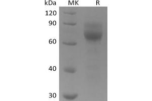 Tyrosine protein (His tag)
