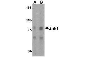Western blot analysis of Grik1 in rat brain tissue lysate with AP30381PU-N Grik1 antibody at (A) 0. (GRIK1 anticorps  (Center))