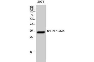 Western Blotting (WB) image for anti-Heterogeneous Nuclear Ribonucleoprotein C (C1/C2) (HNRNPC) (Ser484) antibody (ABIN3185059) (HNRNPC anticorps  (Ser484))