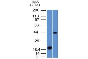 Western Blot Analysis (A) Recombinant Protein (B) Human Liver lysate Aurora B Mouse Monoclonal Antibody (AURKB/1521). (Aurora Kinase B anticorps  (AA 89-251))