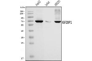 Western blot analysis of IMPI/IGF2BP1 using anti-IMPI/IGF2BP1 antibody (ABIN7602492).