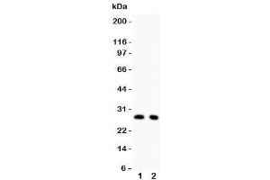 Western blot testing of p27KIP1 antibody and Lane 1:  rat thymus