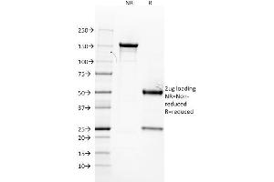 SDS-PAGE Analysis Purified Estrogen Receptor alpha Mouse Monoclonal Antibody (ER506). (Estrogen Receptor alpha anticorps  (AA 2-185))