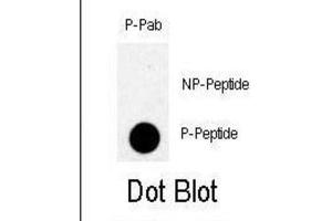 anti-TBK (pSer172) antibody