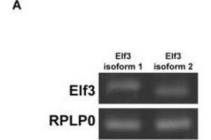 Elf3 overexpression enhanced basal and vasopressin-induced AQP2 promoter activity and transcription. (ELF3 anticorps  (AA 1-280))