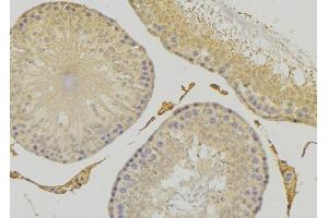 ABIN6279276 at 1/100 staining RAT testis tissue by IHC-P. (CEP41 anticorps  (Internal Region))