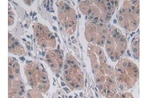 Detection of MTHFR in Human Stomach Tissue using Polyclonal Antibody to Methylenetetrahydrofolate Reductase (MTHFR)