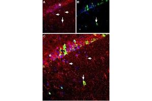 Expression of GDNF in rat hippocampus - Immunohistochemical staining of rat hippocampus frozen sections with Anti-GDNF Antibody (ABIN7043216, ABIN7044765 and ABIN7044766), (1:100), (red).