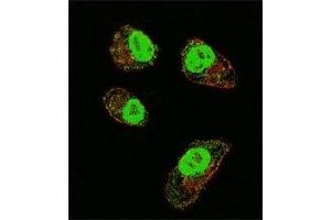 Confocal immunofluorescent analysis of HIF1A antibody with MDA-MB231 cells followed by Alexa Fluor 488-conjugated goat anti-rabbit lgG (green). (HIF1A anticorps  (AA 519-547))