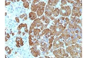 IHC testing of FFPE human pituitary gland with ACTH antibody (clone CLIP/1449). (CLIP anticorps  (AA 25-39))
