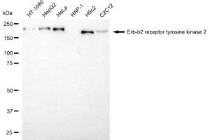Western blotting analysis using erb-b2 receptor tyrosine kinase 2 antibody (ABIN7800157). (ErbB2/Her2 anticorps)