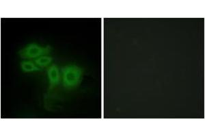 Immunofluorescence (IF) image for anti-STE20-Like Kinase (SLK) (AA 1151-1200) antibody (ABIN2879164) (SLK anticorps  (AA 1151-1200))