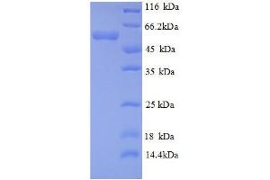 Protein expressed in E. (Hexokinase 1 Protein (HK1) (AA 1-485) (His tag))