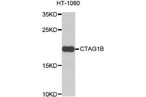 Western blot analysis of extracts of HT-1080 cells, using CTAG1B antibody. (CTAG1B anticorps)