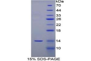 SDS-PAGE of Protein Standard from the Kit (Highly purified E. (SAA Kit ELISA)