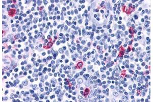 anti-Chemokine (C-X-C Motif) Receptor 3 (CXCR3) (C-Term) antibody