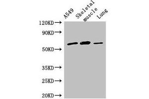 Western Blot Positive WB detected in: A549 whole cell lysate, Mouse skeletal muscle tissue, Rat lung tissue All lanes: AOAH antibody at 2. (AOAH anticorps  (AA 180-254))