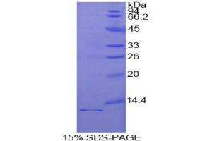 SDS-PAGE (SDS) image for Interleukin 1 Receptor, Type I (IL1R1) (AA 21-109) protein (His tag) (ABIN1170728)