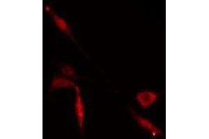 ABIN6274929 staining  Hela cells by IF/ICC. (BAZ2A anticorps  (N-Term))