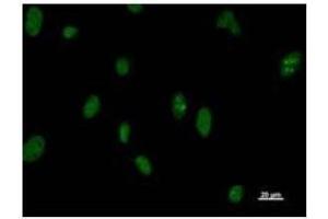 Immunostaining analysis in HeLa cells.
