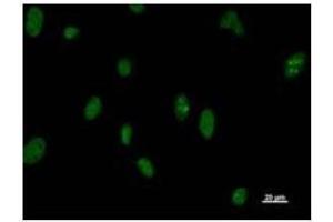Immunostaining analysis in HeLa cells. (DDX5 anticorps)