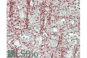 ABIN571099 (3. (Tppp anticorps  (Internal Region))