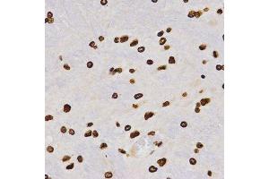 anti-Histone H4 (2meLys20) antibody