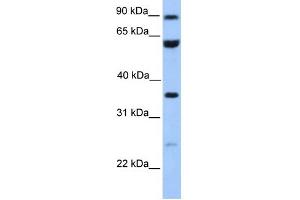 WB Suggested Anti-CCDC7 Antibody Titration: 0. (CCDC7 anticorps  (N-Term))