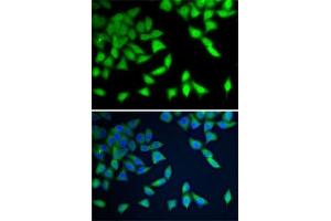 Immunofluorescence analysis of A-549 cells using WDR77 antibody (ABIN6128227, ABIN6150205, ABIN6150206 and ABIN6222948). (WDR77 anticorps  (AA 1-260))