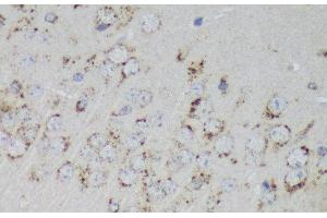 Immunohistochemistry of paraffin-embedded Mouse brain using PSAP Polyclonal Antibody at dilution of 1:200 (40x lens). (Prosaposin anticorps)