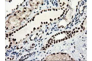 Immunohistochemical staining of paraffin-embedded Human Kidney tissue using anti-NMNAT1 mouse monoclonal antibody. (NMNAT1 anticorps)