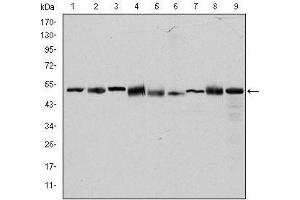 Western blot analysis using CCT2 mouse mAb against Hela (1), MCF-7 (2), Jurkat (3), T47D (4), K562 (5), A431 (6), NIH/3T3 (7), PC-12 (8) and Cos7 (9) cell lysate. (CCT2 anticorps)